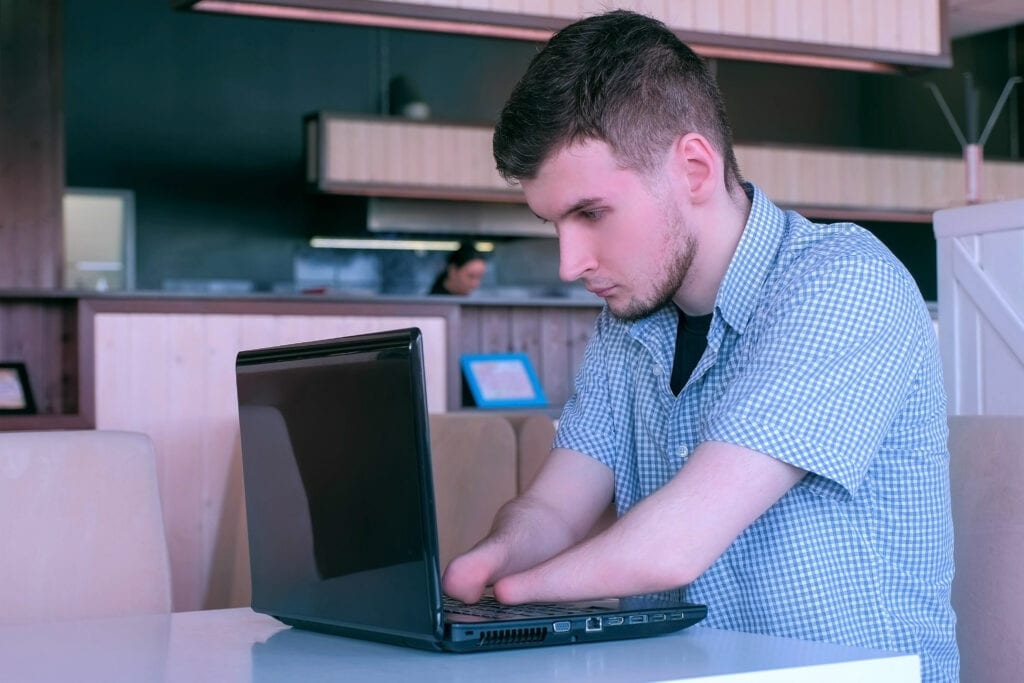 Man with amputated hands using a laptop.